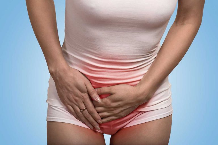 Soigner une mycose vaginale avec des remèdes naturels