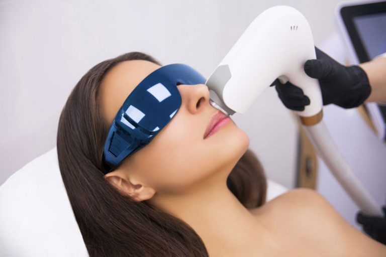 L&rsquo;épilation à la lumière pulsée : cinq conseils avant de se lancer !