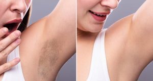 Comment avoir des aisselles blanches et sans odeur ? aisselles blanches et sans odeur