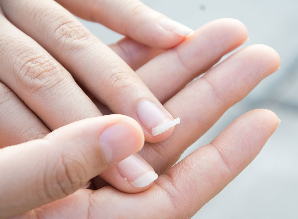 Astuces pour réparer un ongle cassé
