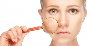 Comment traiter les tâches pigmentaires ? tâches pigmentaires