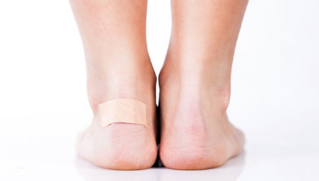 soulager les ampoules au pieds soulager les ampoules au pieds