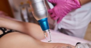 Que devriez-vous savoir sur le détatouage au laser ? Lle détatouage au laser : mode de fonctionnement