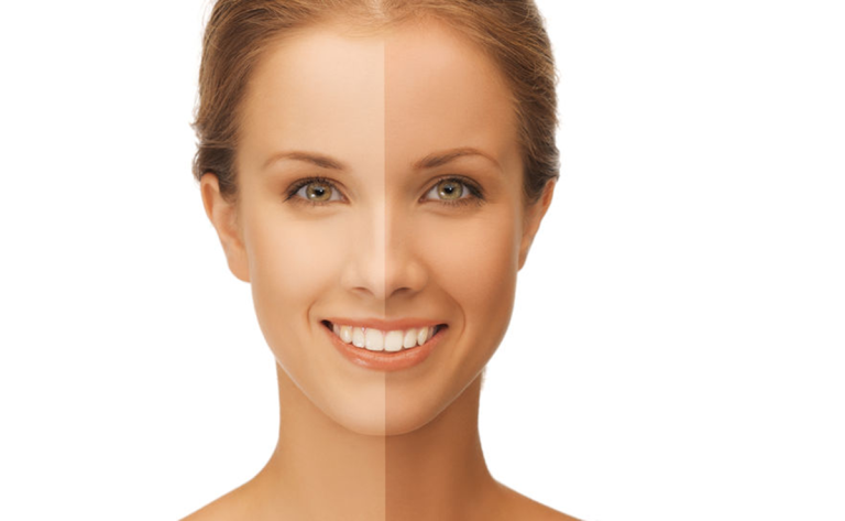 Être bronzé en hiver : 5 astuces naturelles pour garder son bronzage
