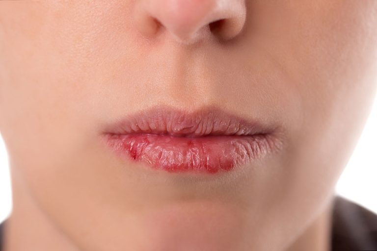 Lip slugging : L&rsquo;astuce anti lèvres gercées !