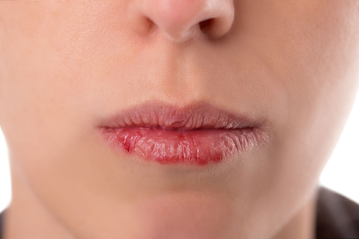 Lip slugging : L&rsquo;astuce anti lèvres gercées !