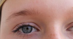 Les solutions pour relever les paupières tombantes sans chirurgie paupière tombante