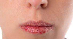 Lip slugging : L’astuce anti lèvres gercées ! Lip slugging