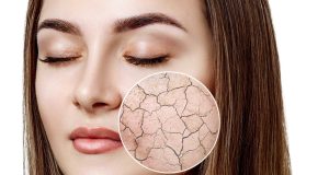 Comment prendre soin d’une peau sèche ? prendre soin d'une peau sèche